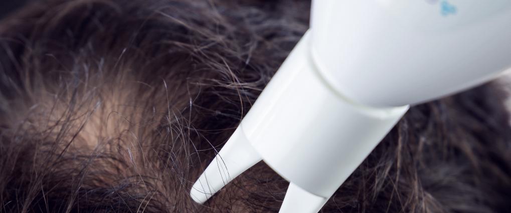 Dünne, feine Haare Dünne, feine Haare